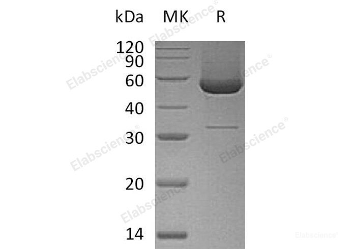 Recombinant Human Serpin H1 Protein(C-6His)-Elabscience