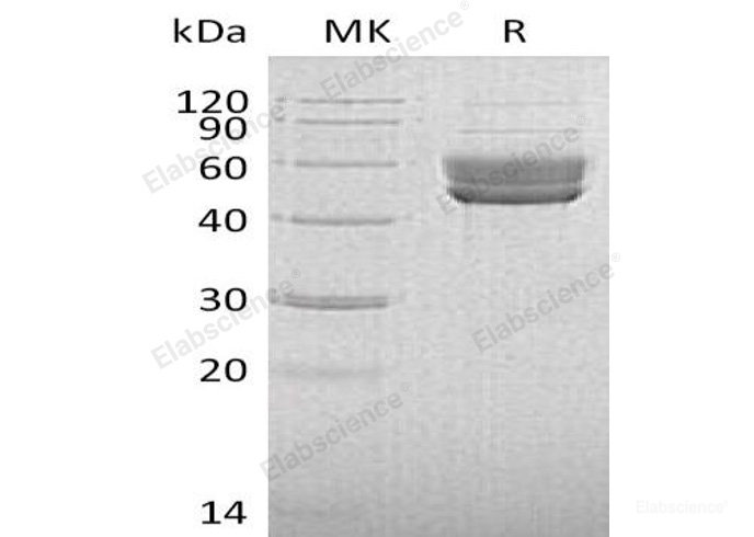 Recombinant Human Serpin I2 Protein(C-6His)-Elabscience