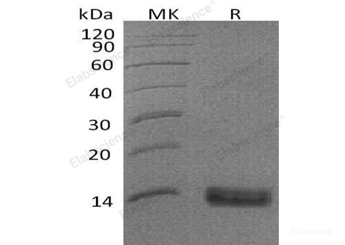 Recombinant Human Serpin Kazal-1 Protein(C-6His)-Elabscience
