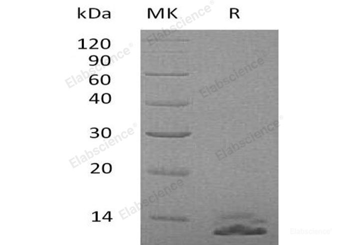 Recombinant Human Serpin Kazal-7/SPINK7/ECG2 Protein(C-6His)-Elabscience