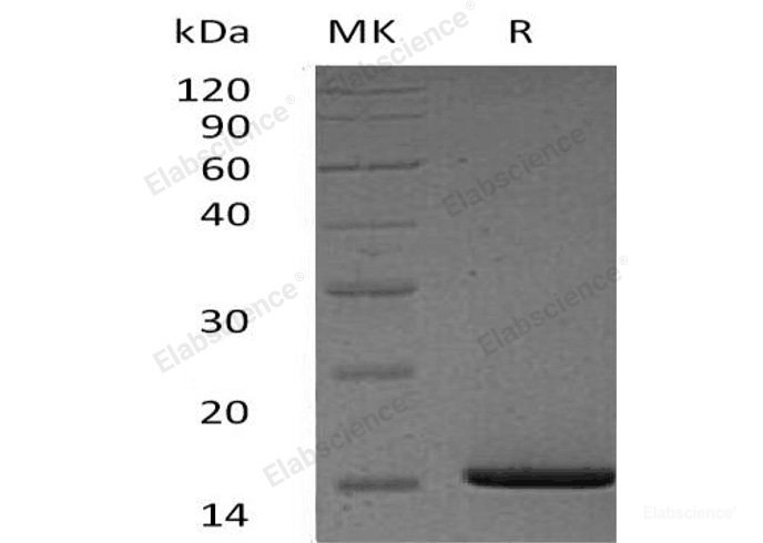 Recombinant Human Serum Amyloid A1/SAA1 Protein(N-6His)-Elabscience