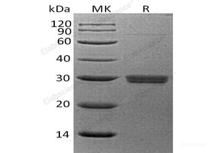 Recombinant Human Serum Amyloid P-Component/Pentraxin 2/SAP Protein(C-6His)-Elabscience