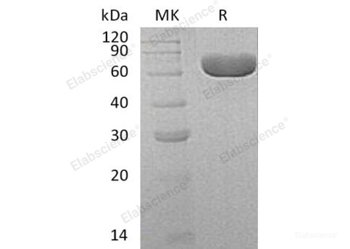 Recombinant Human Sialate O-Acetylesterase/SIAE Protein(C-6His)-Elabscience