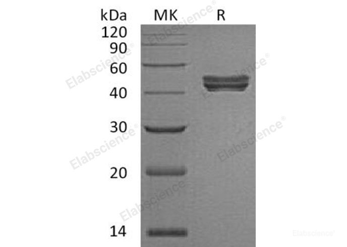 Recombinant Human Sialidase-1/NEU-1 Protein(C-6His)-Elabscience