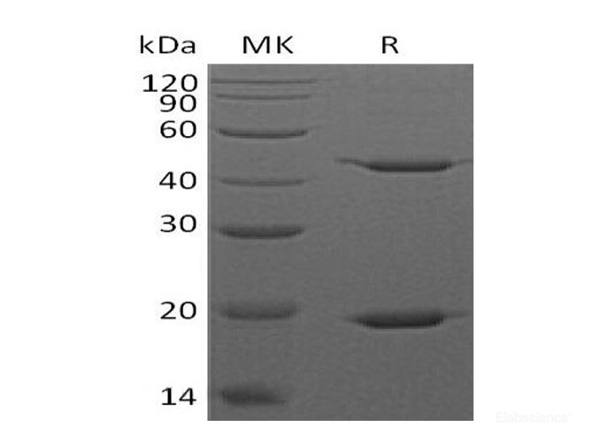 Recombinant Human Signal Transducer and Activator of Transcription 3/STAT3 Protein(C-6His)-Elabscience