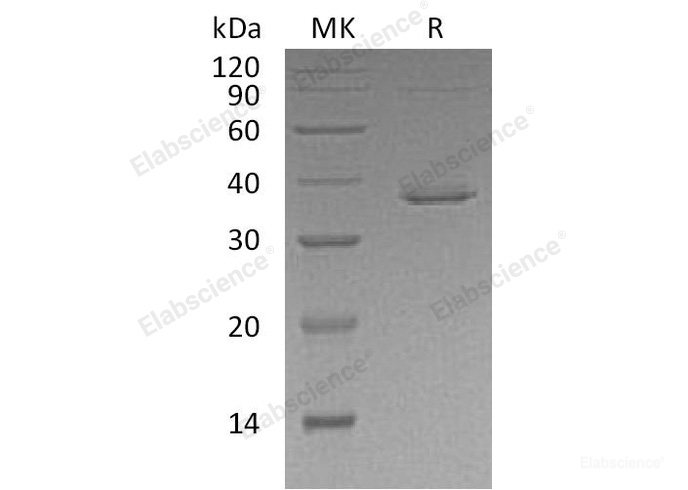 Recombinant Human Signal Transducer and Activator of Transcription 5B/STAT5B Protein(C-6His)-Elabscience