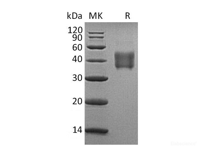 Recombinant Human SLAM Family Member 5/SLAMF5/CD84 Protein(C-6His)-Elabscience