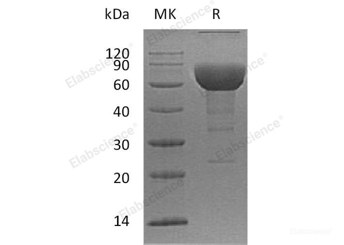 Recombinant Human SLAM Family Member 6/SLAMF6/CD352/NTB-A Protein(C-Fc)-Elabscience