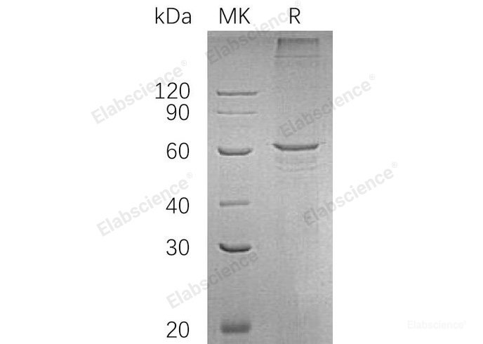 Recombinant Human SMAD Family Member 4/SMAD4/DPC4 Protein(C-6His)-Elabscience