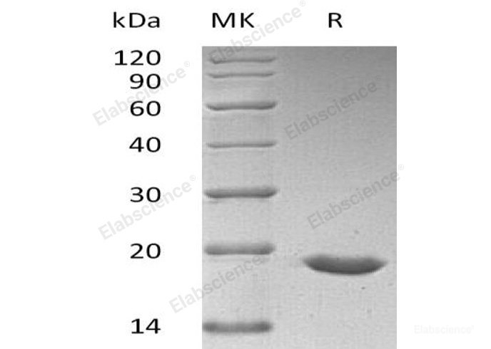 Recombinant Human Small Ubiquitin-Related Modifier 3/SUMO3/SMT3A Protein(N-6His)-Elabscience