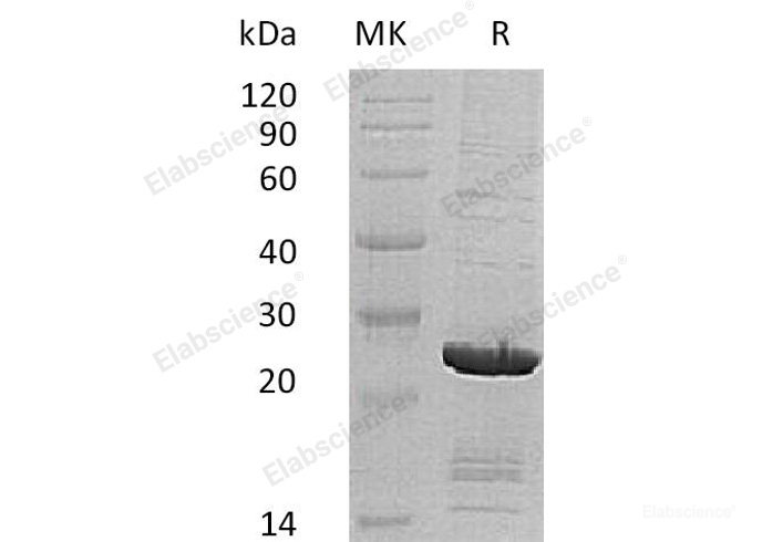 Recombinant Human SOD2/Mn-SOD Protein(C-6His, Cells)-Elabscience