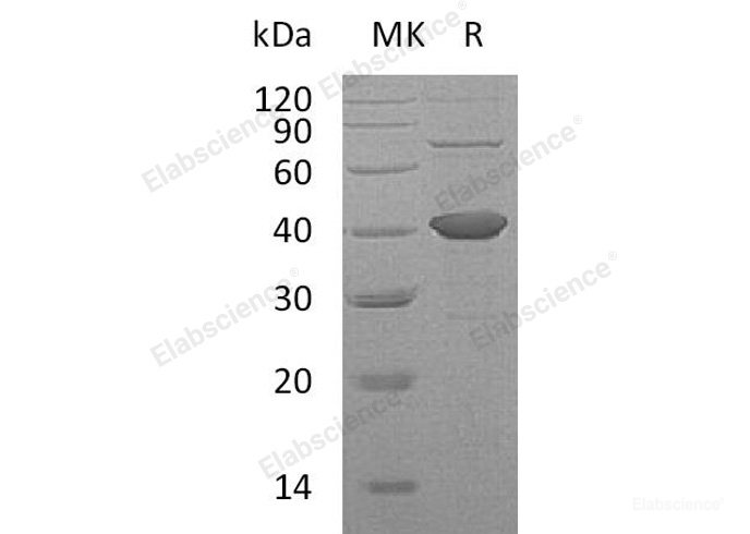 Recombinant Human Sorbitol Dehydrogenase/SORD Protein(C-6His)-Elabscience