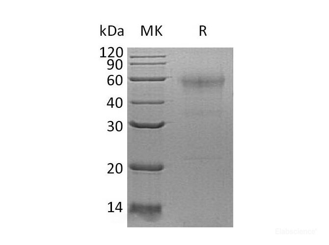 Recombinant Human Sperm Equatorial Segment Protein 1/SPESP1 Protein(C-6His)-Elabscience
