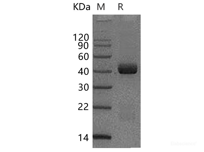 Recombinant Human Spondin 2/SPON2/Mindin Protein(C-6His)-Elabscience