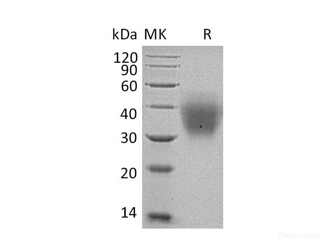 Recombinant Human Stem Cell Factor/SCF/c-Kit Ligand Protein(C-6His)-Elabscience