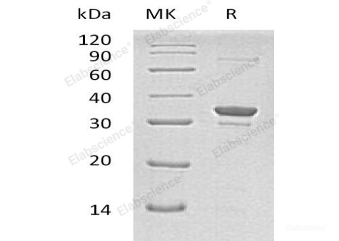 Recombinant Human Sulfotransferase 1A2/SULT1A2 Protein(N-6His)-Elabscience