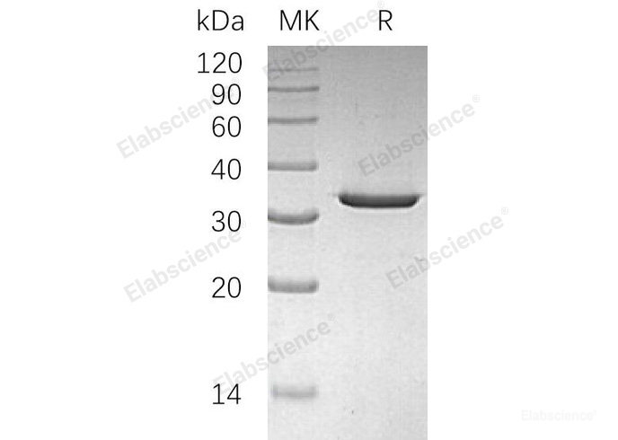 Recombinant Human Sulfotransferase 4A1/SULT4A1 Protein-Elabscience