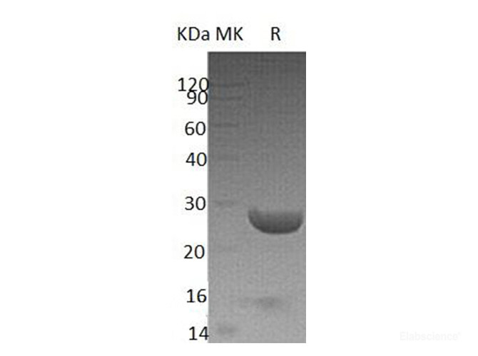 Recombinant Human Synaptobrevin Homolog YKT6/YKT6 Protein(N-6His)-Elabscience