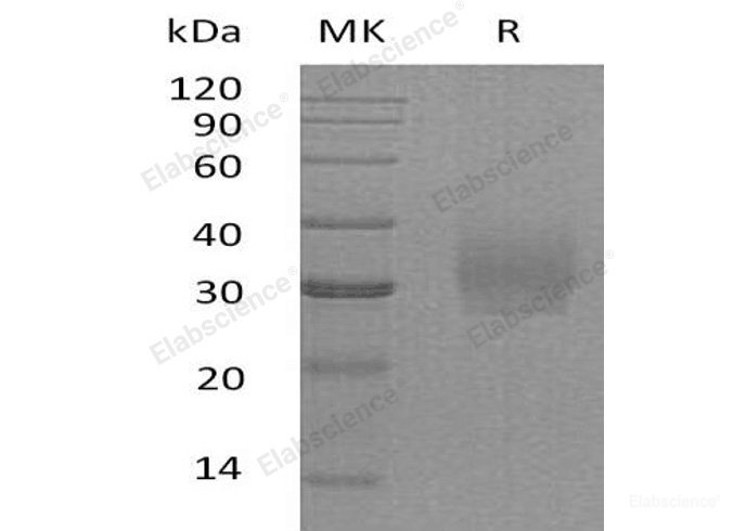 Recombinant Human Syndecan-2/SDC2/CD362 Protein(C-6His)-Elabscience