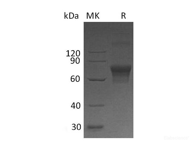 Recombinant Human T Cell Immunoglobulin and Mucin Domain-3/TIM-3/HAVCR2 Protein(C-Fc-6His)-Elabscience