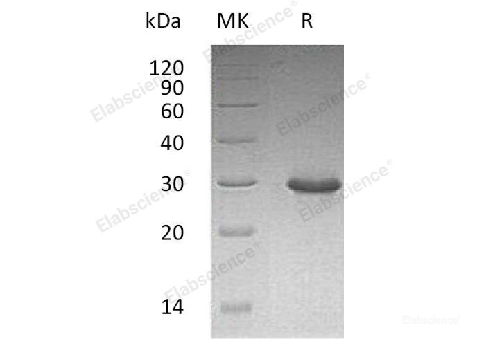 Recombinant Human T Cell Receptor Interacting Molecule/TRIM/TCRIM/TRAT1 Protein(C-6His)-Elabscience