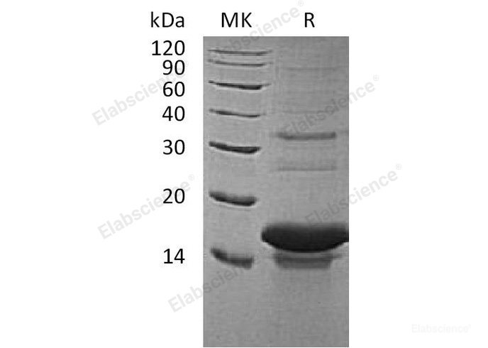 Recombinant Human Tachykinin-3/TAC3 Protein(N-6His)-Elabscience