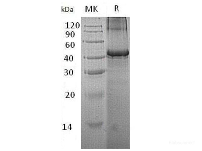 Recombinant Human Testin/TES Protein(C-6His)-Elabscience