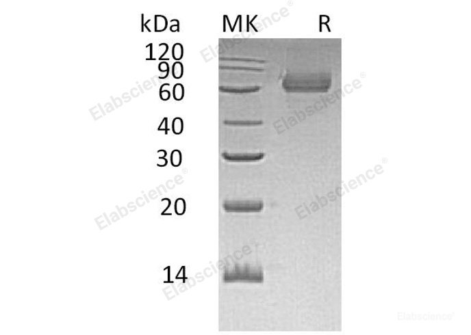 Recombinant Human TGOLN2/TGN38 Homolog/TGN46 Protein(C-6His)-Elabscience