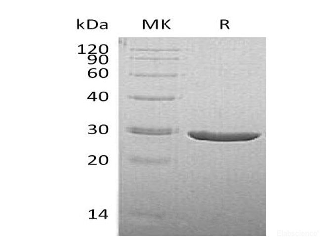 Recombinant Human Thiamin Pyrophosphokinase 1/TPK1 Protein(C-6His)-Elabscience