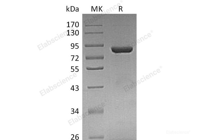 Recombinant Human Thimet Oligopeptidase/THOP1 Protein(C-6His)-Elabscience