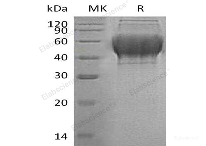 Recombinant Human Thioredoxin Domain-Containing Protein 15/TXNDC15 Protein(C-6His)-Elabscience