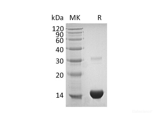Recombinant Human Thioredoxin/TXN Protein(N-6His)-Elabscience