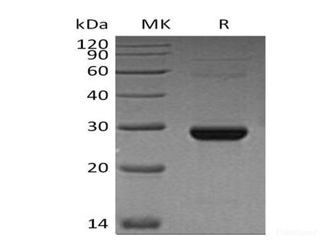 Recombinant Human Thymidine Kinase, Cytosolic/TK1 Protein(C-6His)-Elabscience