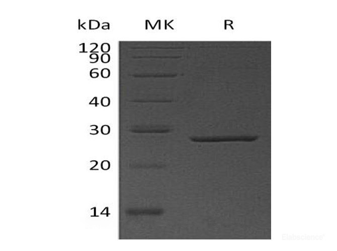 Recombinant Human Thymidylate Kinase/DTYMK Protein(C-6His)-Elabscience