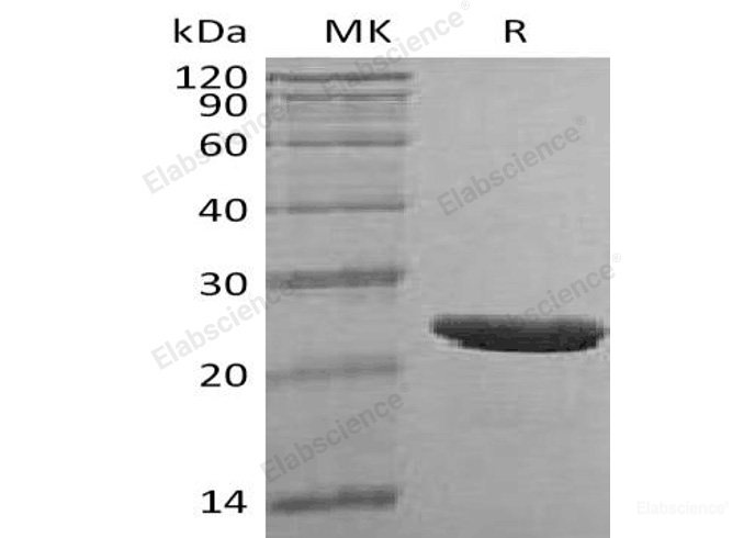 Recombinant Human Thymopoietin/TMPO/LAP2 Protein(C-6His)-Elabscience
