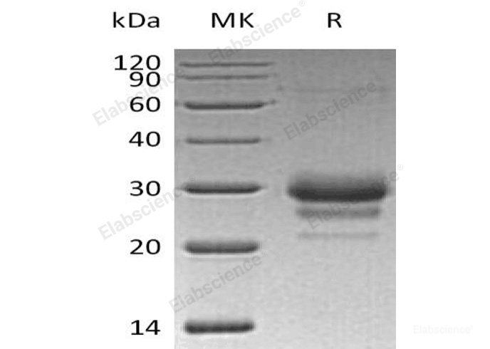 Recombinant Human Tissue Factor Pathway Inhibitor 2/TFPI-2/PP5/REF-1 Protein(C-6His)    -Elabscience