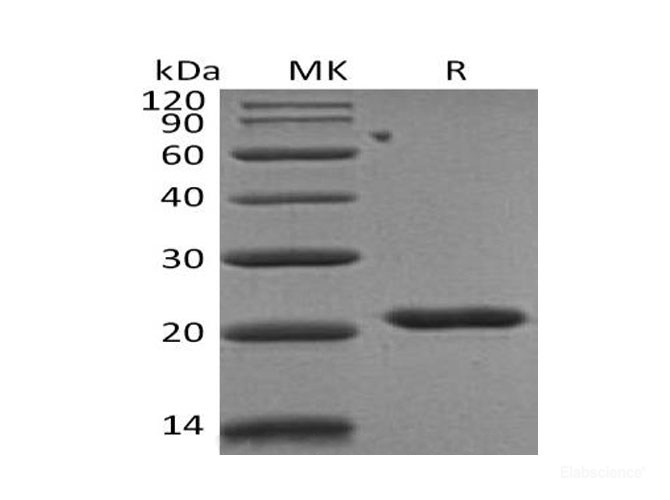 Recombinant Human Tissue Inhibitor of Metalloproteinases 2/TIMP-2 Protein(C-6His)-Elabscience