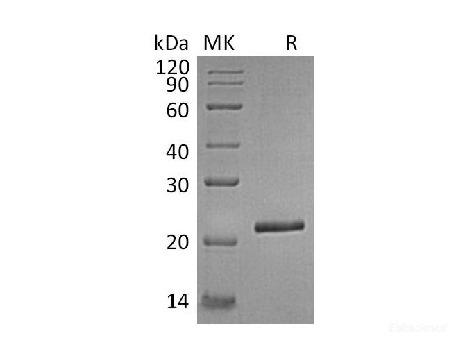 Recombinant Human Tissue Inhibitor of Metalloproteinases 4/TIMP-4 Protein(C-6His)-Elabscience
