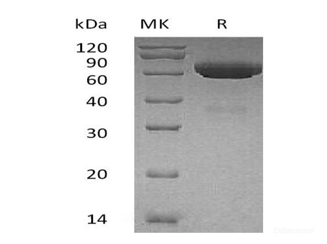 Recombinant Human Tissue-Type Plasminogen Activator/PLAT Protein(C-6His)-Elabscience