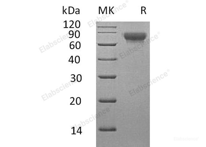 Recombinant Human T-lymphocyte Surface Antigen Ly-9/SLAMF3/CD229 Protein(C-6His)-Elabscience