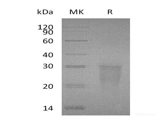 Recombinant Human TMIGD2/IGPR-1/CD28H Protein(C-6His)-Elabscience