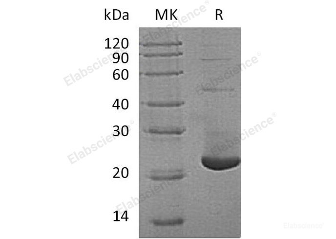 Recombinant Human TMX2/TXNDC14 Protein(N-6His)-Elabscience