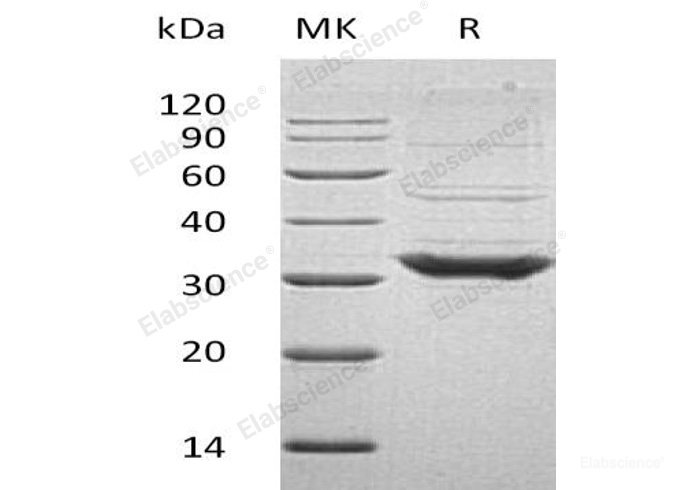 Recombinant Human Toll-Interacting Protein/TOLLIP Protein(C-6His)-Elabscience