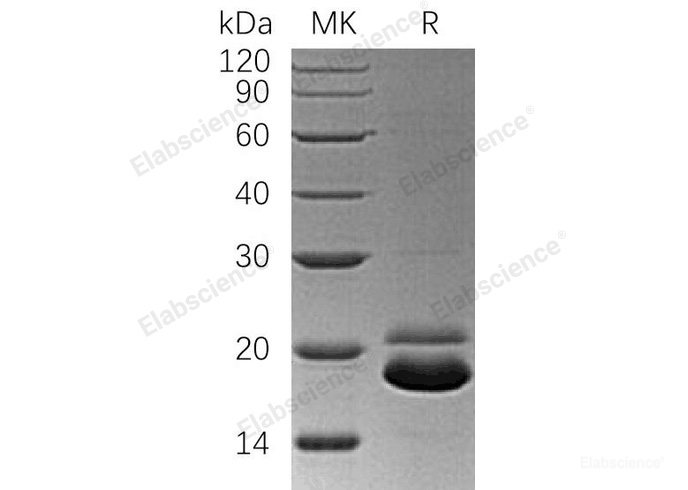 Recombinant Human TRAIL R2/TNFRSF10B/DR5/CD262 Protein(C-6His)-Elabscience
