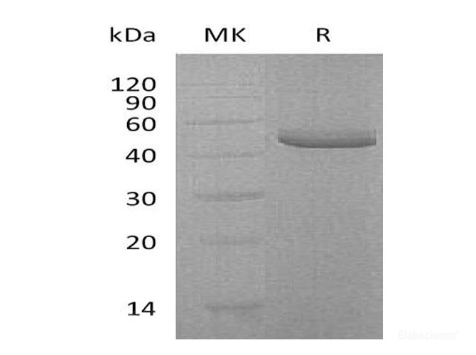 Recombinant Human TRAIL R2/TNFRSF10B/DR5/CD262 Protein(C-Fc-6His)-Elabscience