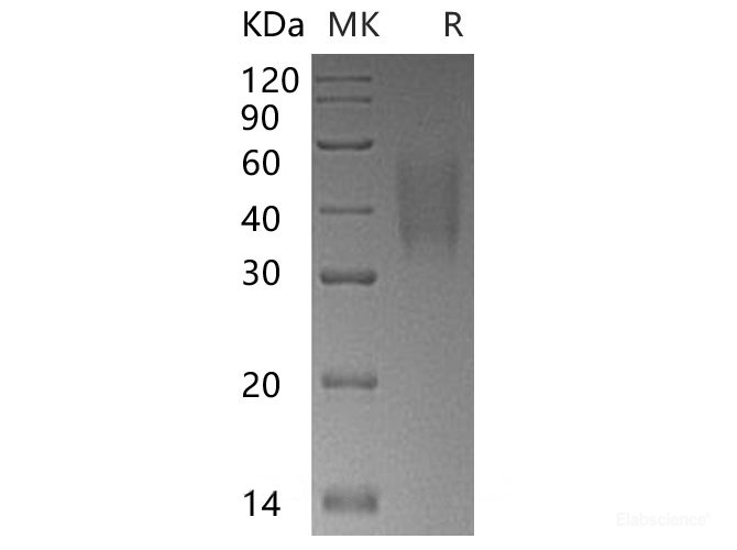 Recombinant Human TRAIL R3/TNFRSF10C/CD263 Protein(C-6His)-Elabscience