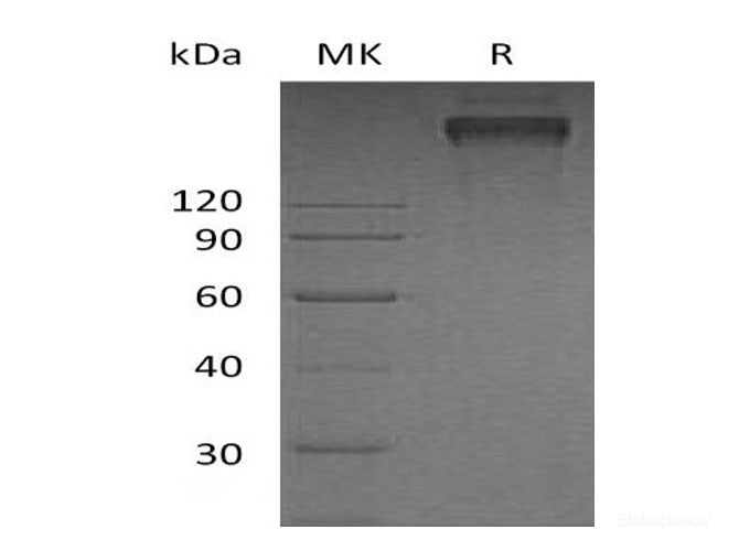 Recombinant Human TRAIL R3/TNFRSF10C/CD263 Protein(C-Fc-6His)-Elabscience