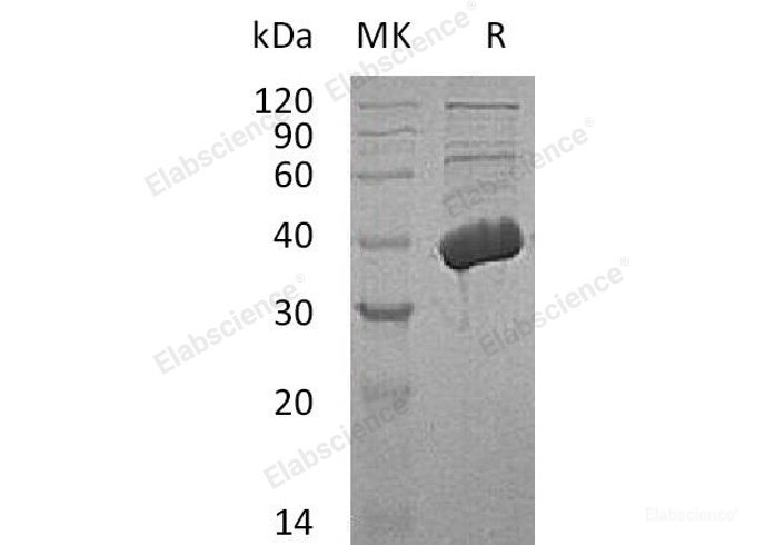 Recombinant Human Trans-2-Enoyl-CoA Reductase Mitochondrial/MECR Protein(C-6His)-Elabscience