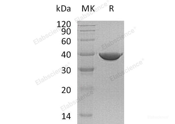 Recombinant Human Transaldolase/TALDO1 Protein(C-6His)-Elabscience