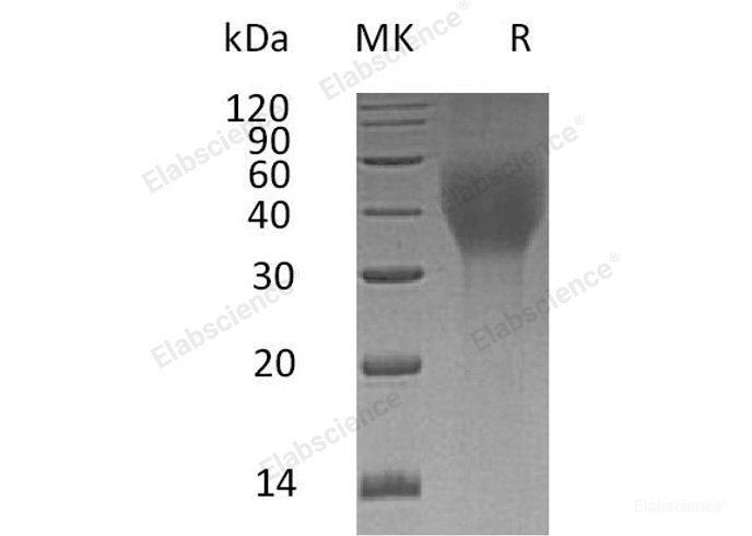 Recombinant Human Transcobalamin II Receptor/TCblR/8D6A/CD320 Protein(C-6His)-Elabscience